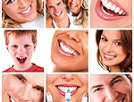 Trattamenti per sbiancare i denti